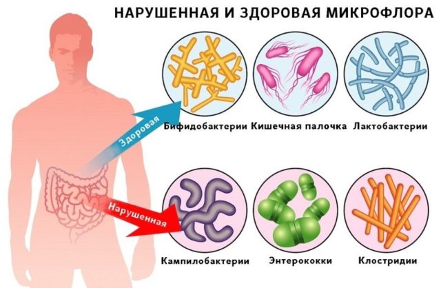 Гастроэнтерит: причины, симптомы, лечение, классификация