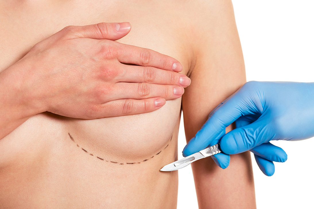 как делают пластическую операцию груди женщин фото 20
