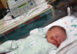 Домашний мониторинг апноэ может предотвратить синдром внезапной смерти у новорожденных